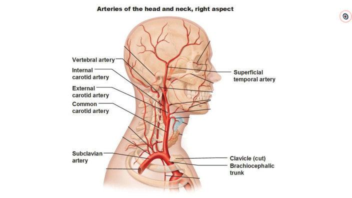 Vascular Pathologies of the Neck by Terry Hugill on Prezi