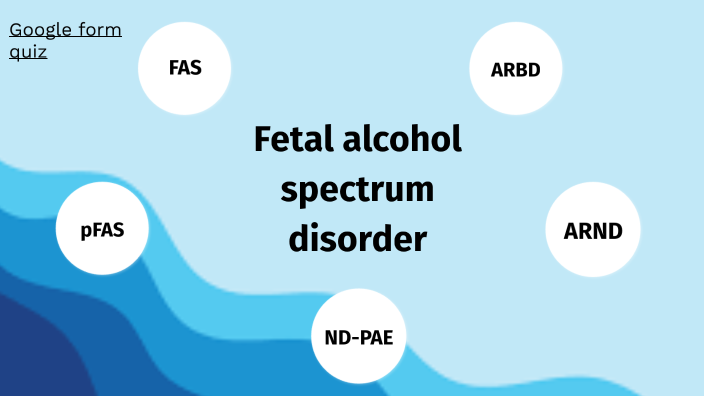 Effects of alcohol by Ella Curtis on Prezi