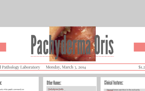 Pachyderma Oris by GianCarlo Eduardo on Prezi