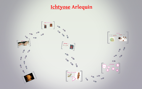 Ichtyose Arlequin By Cinthia Valenzuela On Prezi Next