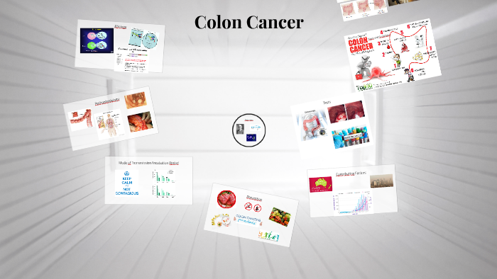 Colon Cancer by Rebecca Maze on Prezi