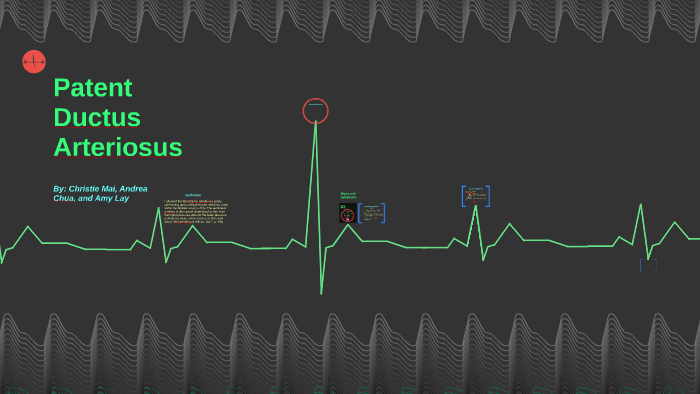 Patent Ductus Arteriosus By Christie Mai