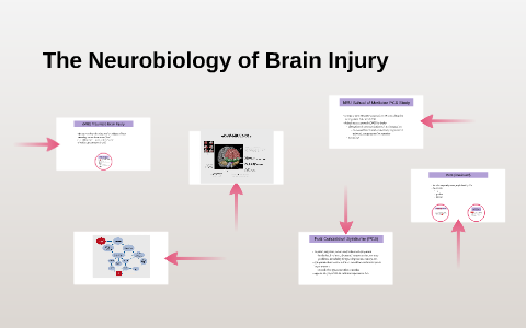 The Neurobiology of Brain Injury by Marina Han on Prezi
