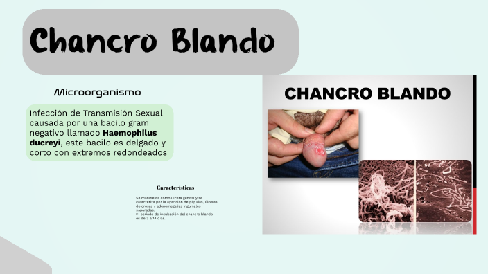 Chancro Blando by NAYRA JAZMIN SILVESTRE MAGNE on Prezi