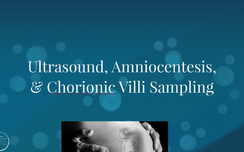 chorionic villi ultrasound