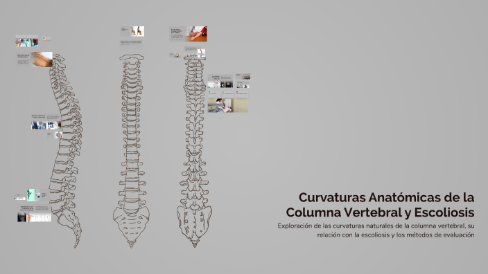 Curvaturas Anatómicas de la Columna Vertebral y Escoliosis by JHON ...