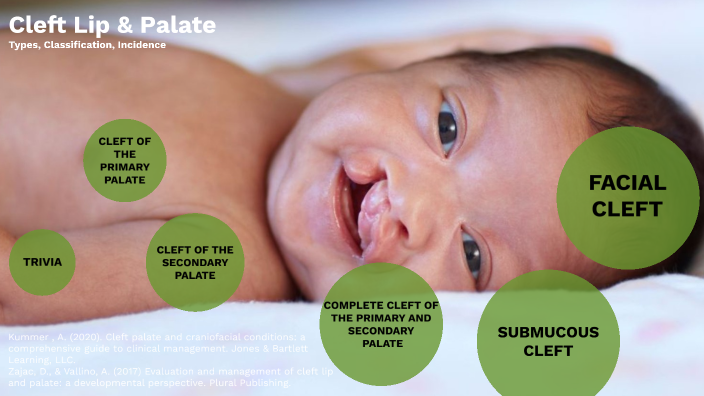 CLP- Types Classification Incidence by Tahira Gibson on Prezi