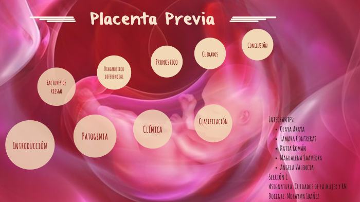 placenta previa by Katia Alejandra on Prezi