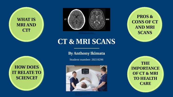 CT and MRI by Anthony Ikimata on Prezi