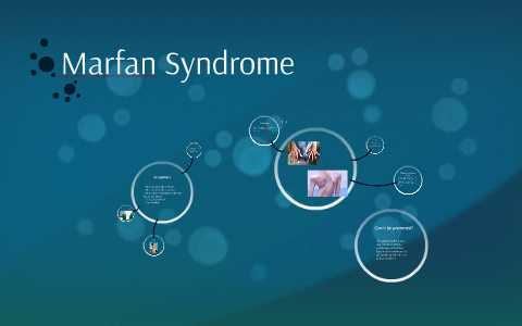 Marfan Syndrome By Lauren Brown On Prezi