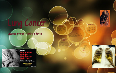 Lung Cancer by on Prezi