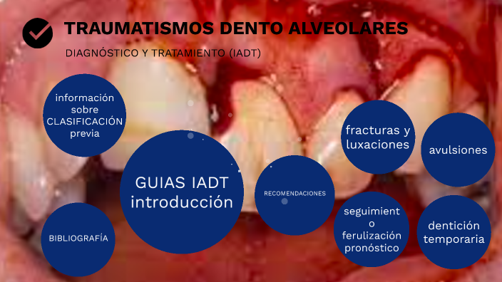 Traumatismos Dento Alveolares By Gutierrez Natalia