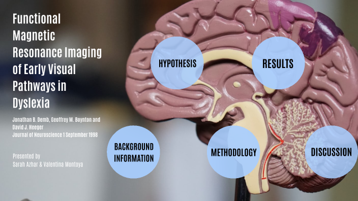 Functional Magnetic Resonance Imafing of Early Visual Pathways in ...