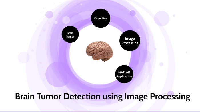 (For Prezi Video) Brain Tumor Detection using Image Processing by ...
