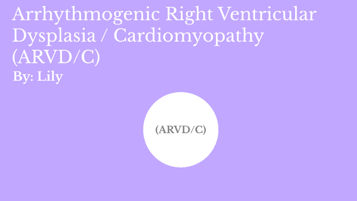 Genetic Disorder- (ARVD/C) by Lily Tadlock on Prezi