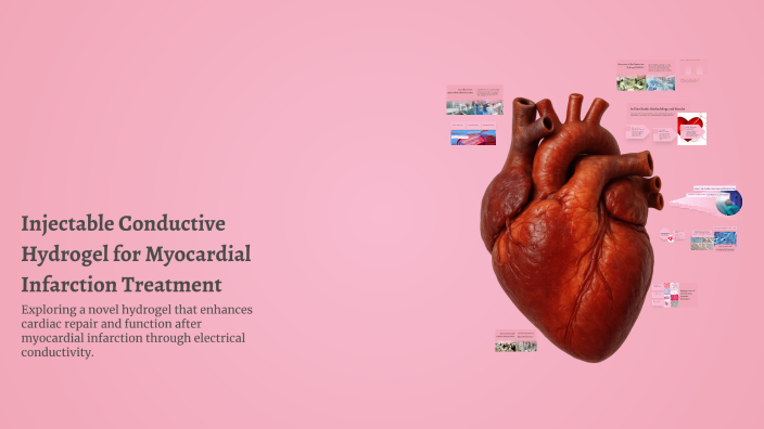 Injectable Conductive Hydrogel for Myocardial Infarction Treatment by ...