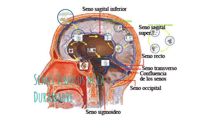 seno sigmoideo