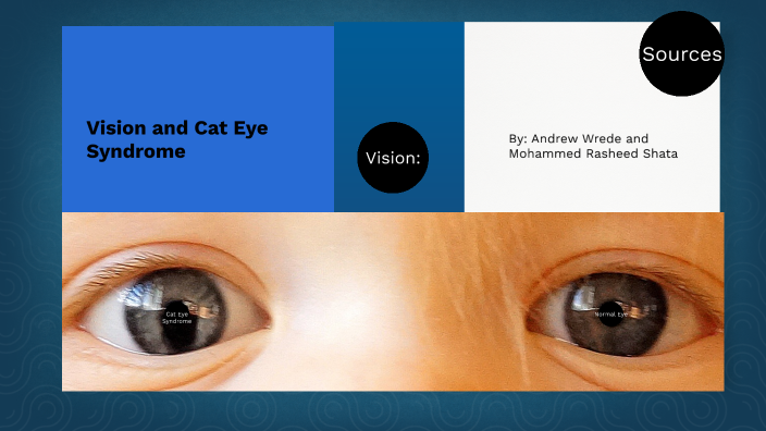 Vision Cat Eye Syndrome By Mohammed Rasheed Shata