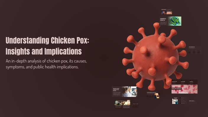 Understanding Chicken Pox: Insights and Implications by MARI DREY on Prezi