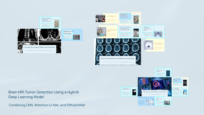Brain MRI Tumor Detection Using a Hybrid Deep Learning Model by Anupam ...