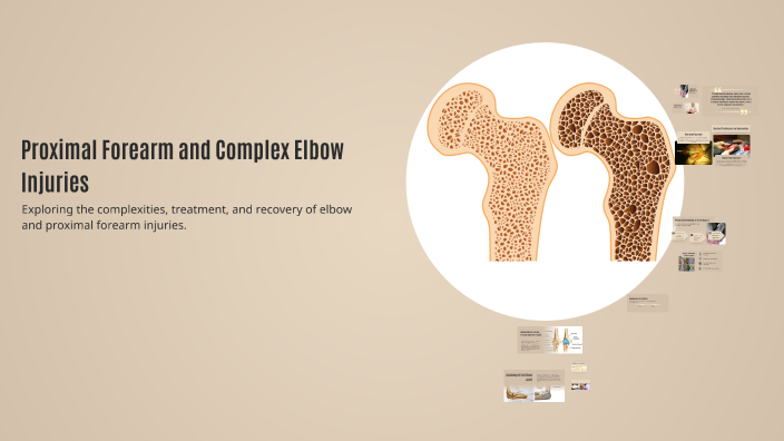 Complex Elbow Injuries Proximal Forearm and Complex Elbow Injuries by Iván Henríquez Otero on ...