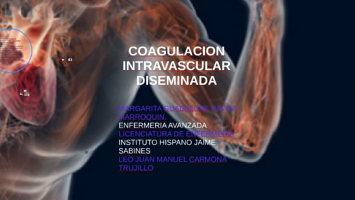 coagulación intravascular diseminada