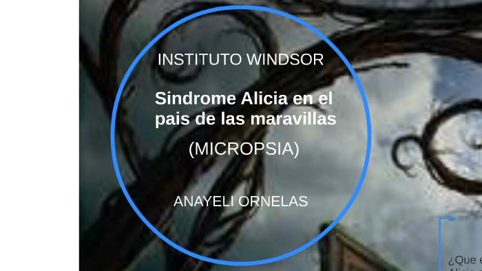 Sindrome De Alicia En El Pais De Las Maravillas By Diana Gonzalez On Prezi 5577