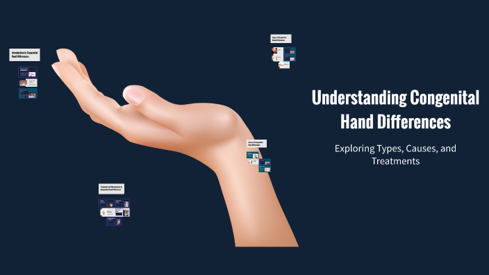 Understanding Congenital Hand Differences by Gopinath Bandari on Prezi