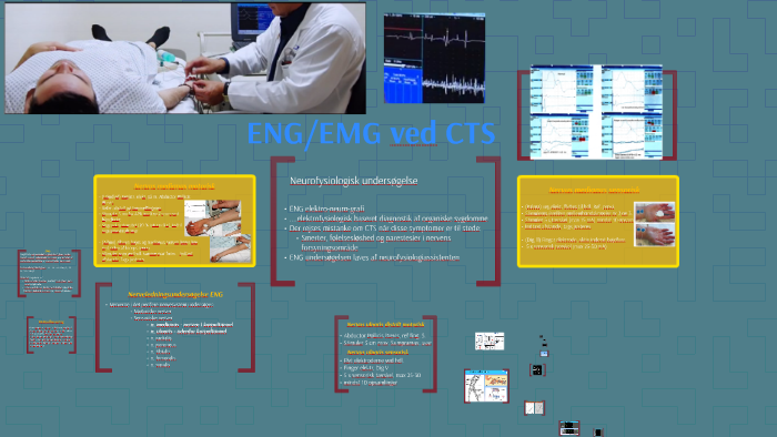 EMG/ENG ved CTS by Siila Geisler on Prezi