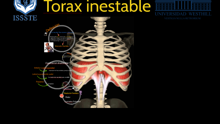 TORAX INESTABLE