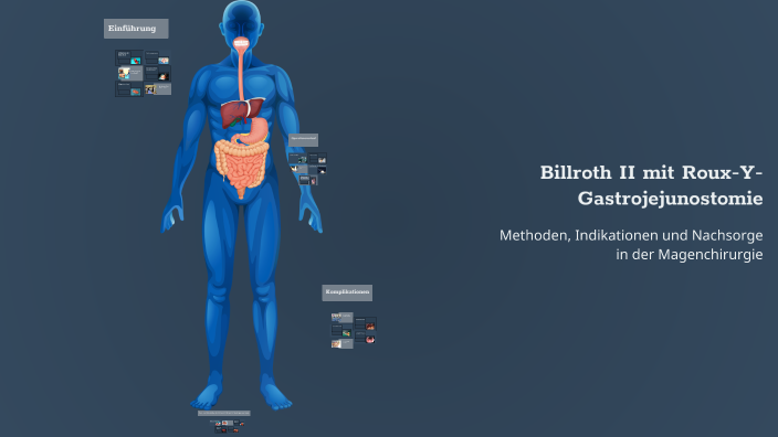 Billroth II mit Roux-Y-Gastrojejunostomie by Carolin Kröker on Prezi