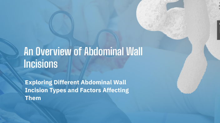 An Overview of Abdominal Wall Incisions by Adham Alkilani on Prezi