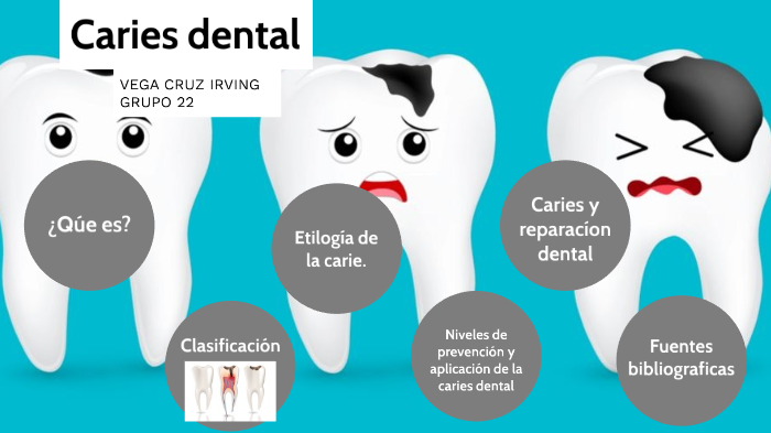 Caries Dental by irving vega cruz on Prezi