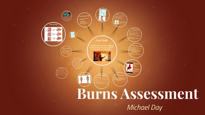 Burns Assessment Tools By Michael Day On Prezi