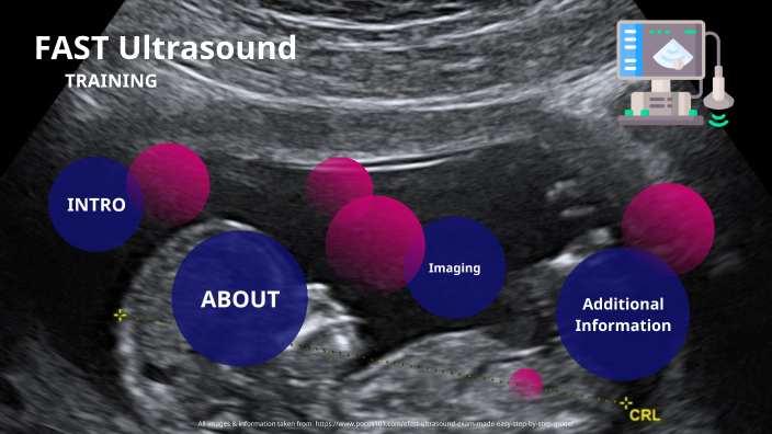 FAST Ultrasound Presentation by Michael Atalla on Prezi
