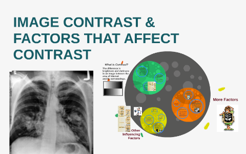 Factors Affecting Radiographic Contrast