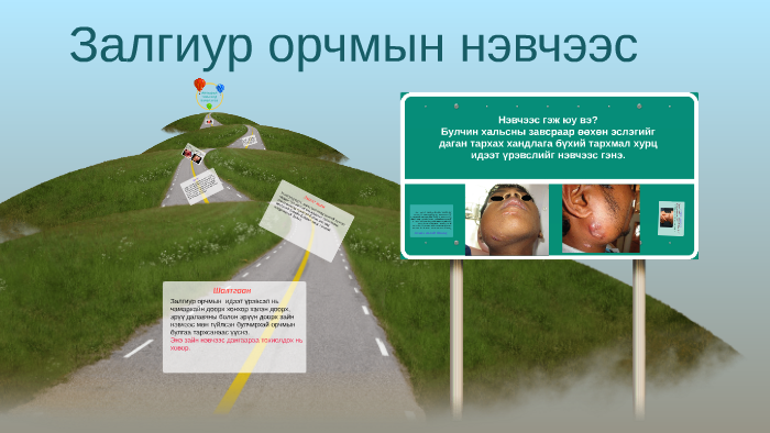 Хүзүүний нэвчээс by А. Тэргэл on Prezi