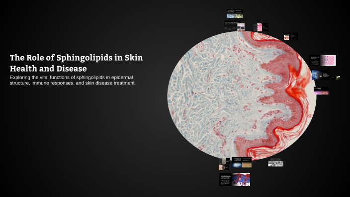 The Role of Sphingolipids in Skin Health and Disease by George Varigos ...