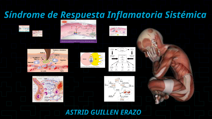 Síndrome de Respuesta Inflamatoria Sistémica by Astrid Guillen on Prezi