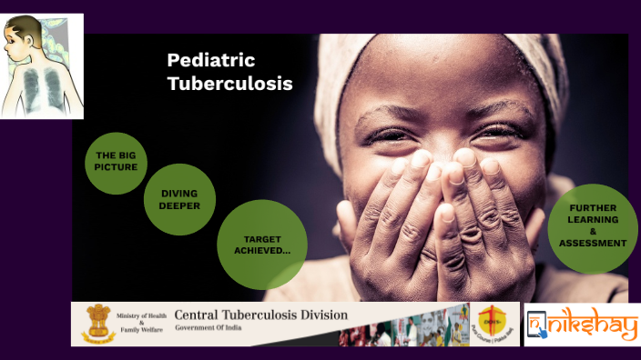 Pediatric Tuberculosis By Vaishnavi Raman On Prezi