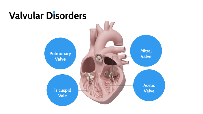 Valvular Disorders by Reece Williams on Prezi