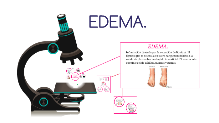 el plasma puede causar edema