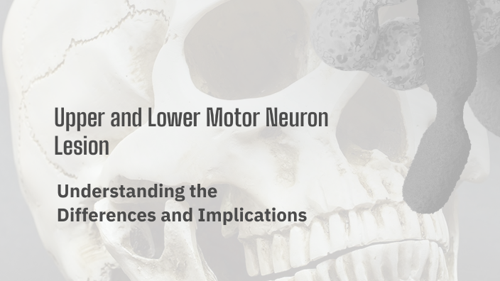 Upper and Lower Motor Neuron Lesions by Mariam Yousef on Prezi