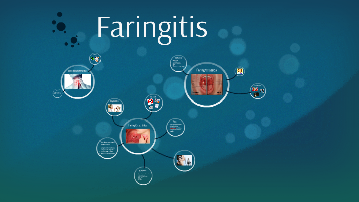 Faringitis seca