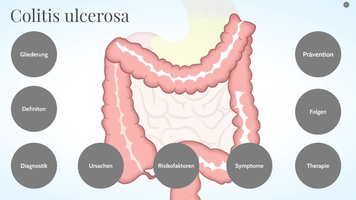 Colitis ulcerosa by Khafia Malik on Prezi