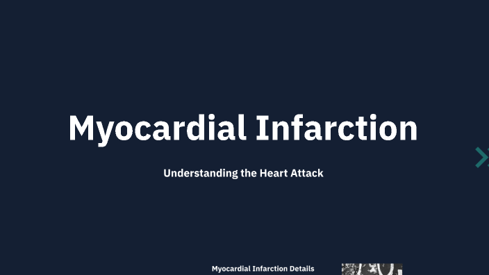 Myocardial Infarction (Heart Attack) by Miles Morgan on Prezi