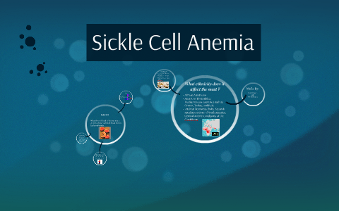 Sickle Cell Anemia by Natalia Gomez