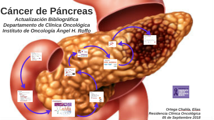 Cáncer de Páncreas by Elias Jesus Ortega Chahla on Prezi