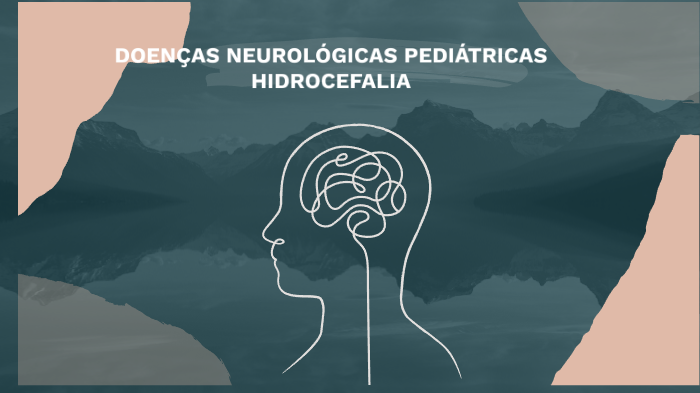 Doenças Neurologicas Pediatricas Hidrocefalia By Eduarda Mota On Prezi 9333