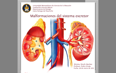 Sistema excretor malformaciones by Erick Kelly on Prezi